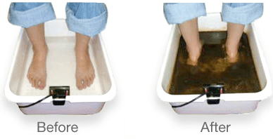 Before & After  - Ionic Detox  Foot Bath