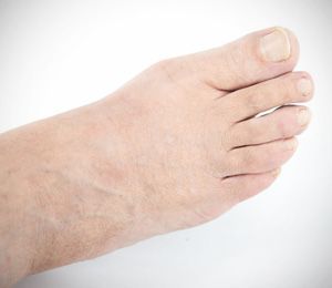 Foot