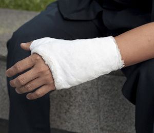 Broken Hand