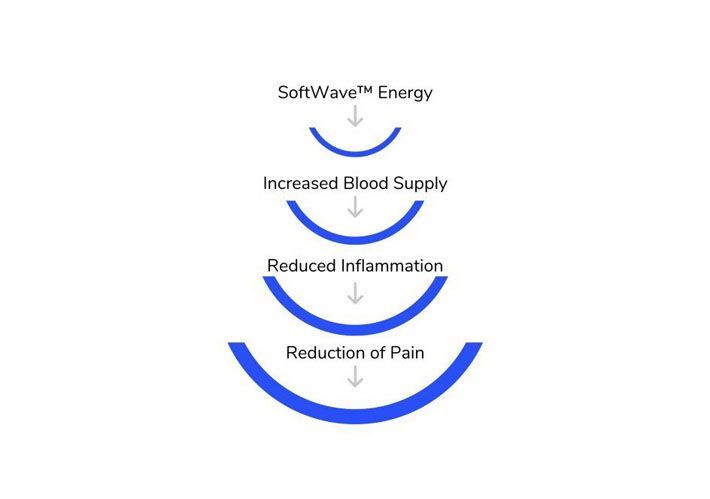 Flowchart showing SoftWave energy leading to increased blood supply, reduced inflammation, and pain reduction.