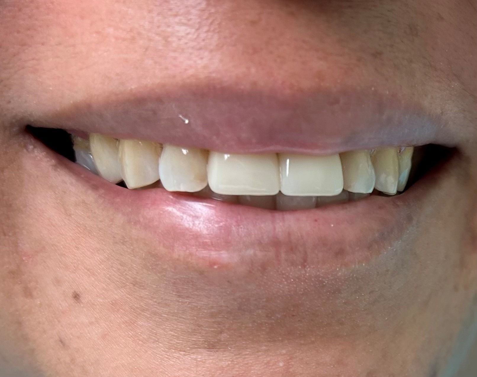 Close-up of a smiling mouth showing white teeth and pink lips