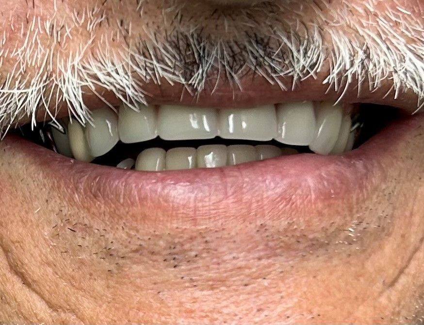 Close-up of a smiling mouth with gray mustache and visible teeth