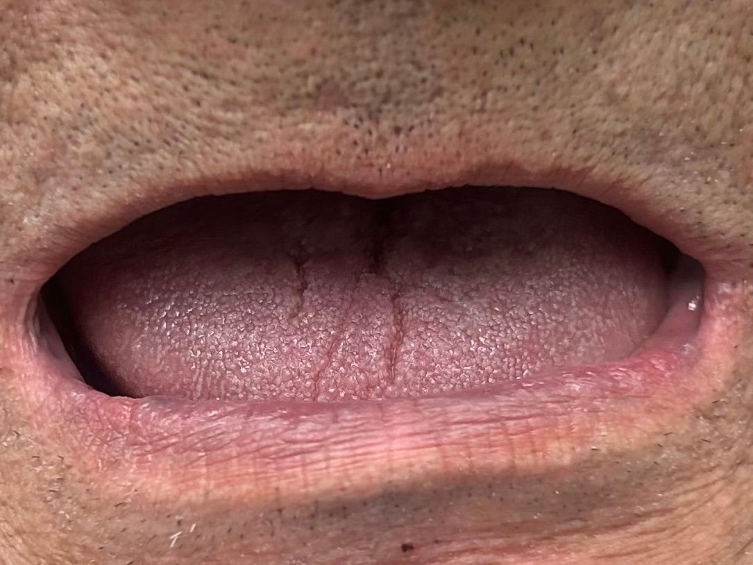 Open human mouth, pink tongue with visible veins and fissures.