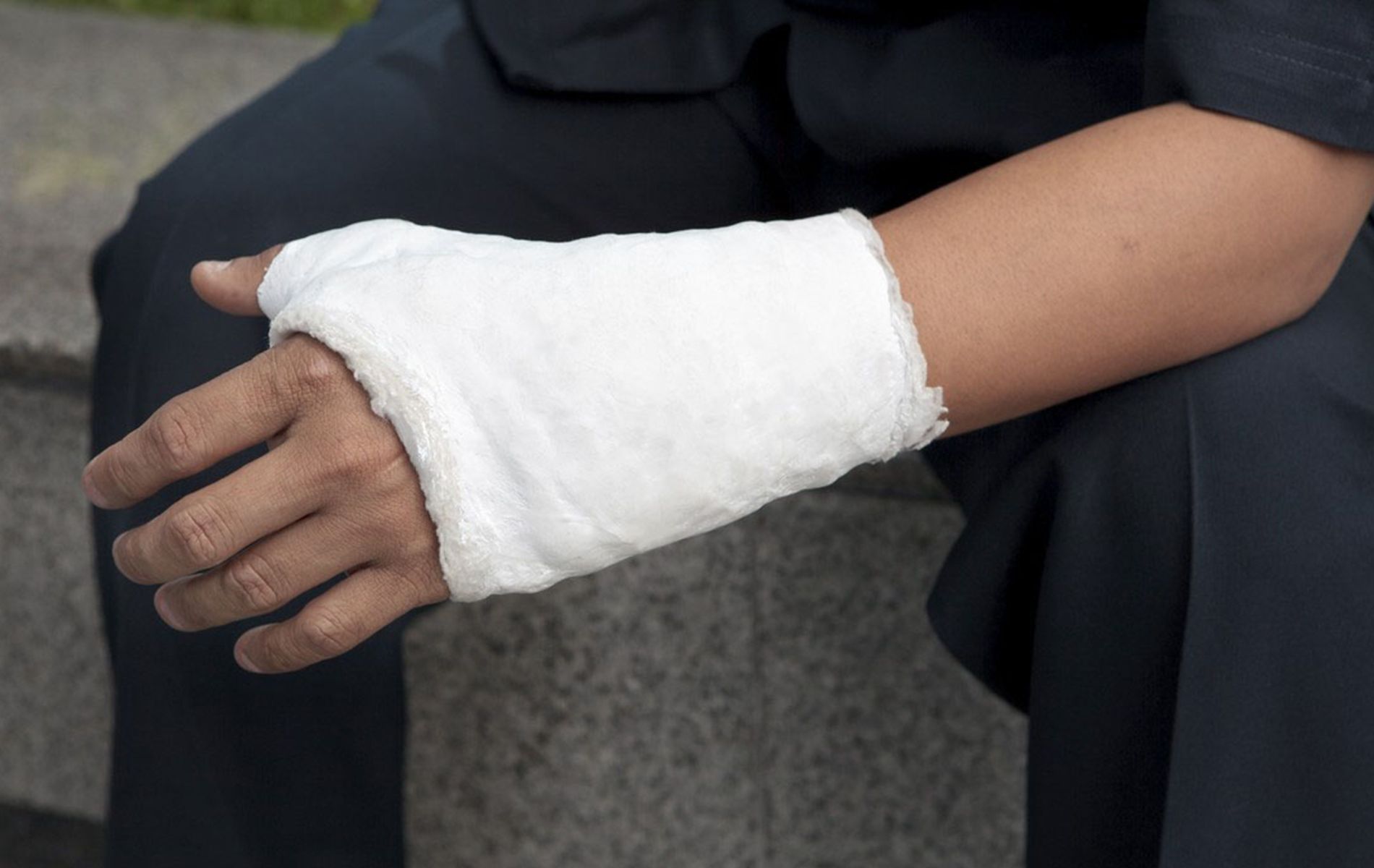 A person with a cast on their hand is sitting on a bench.