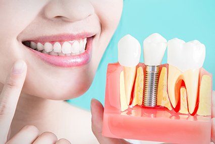 Dental implants service