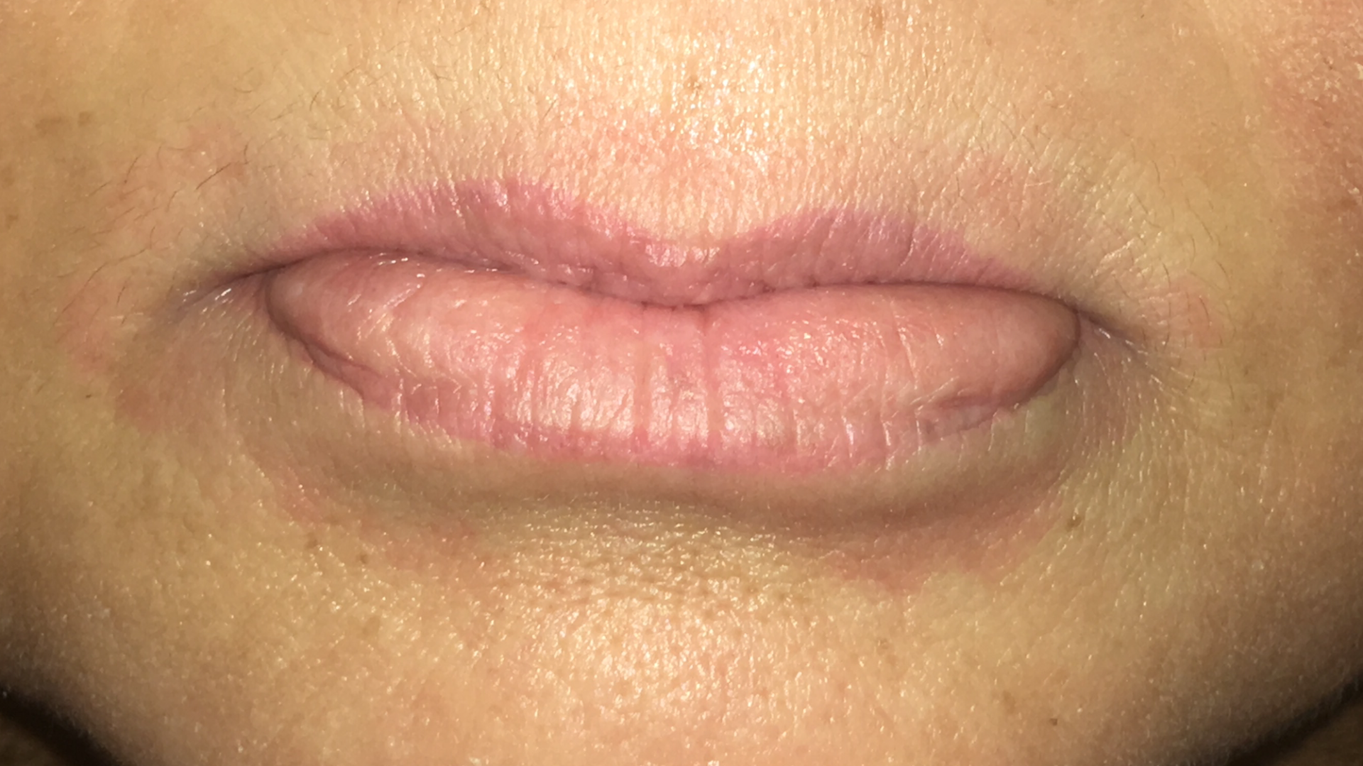Full lip color - before