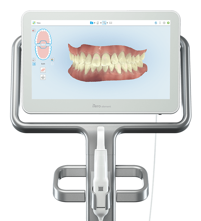 iTero® Intraoral Scanner