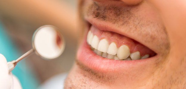 Surgical technique on teeth