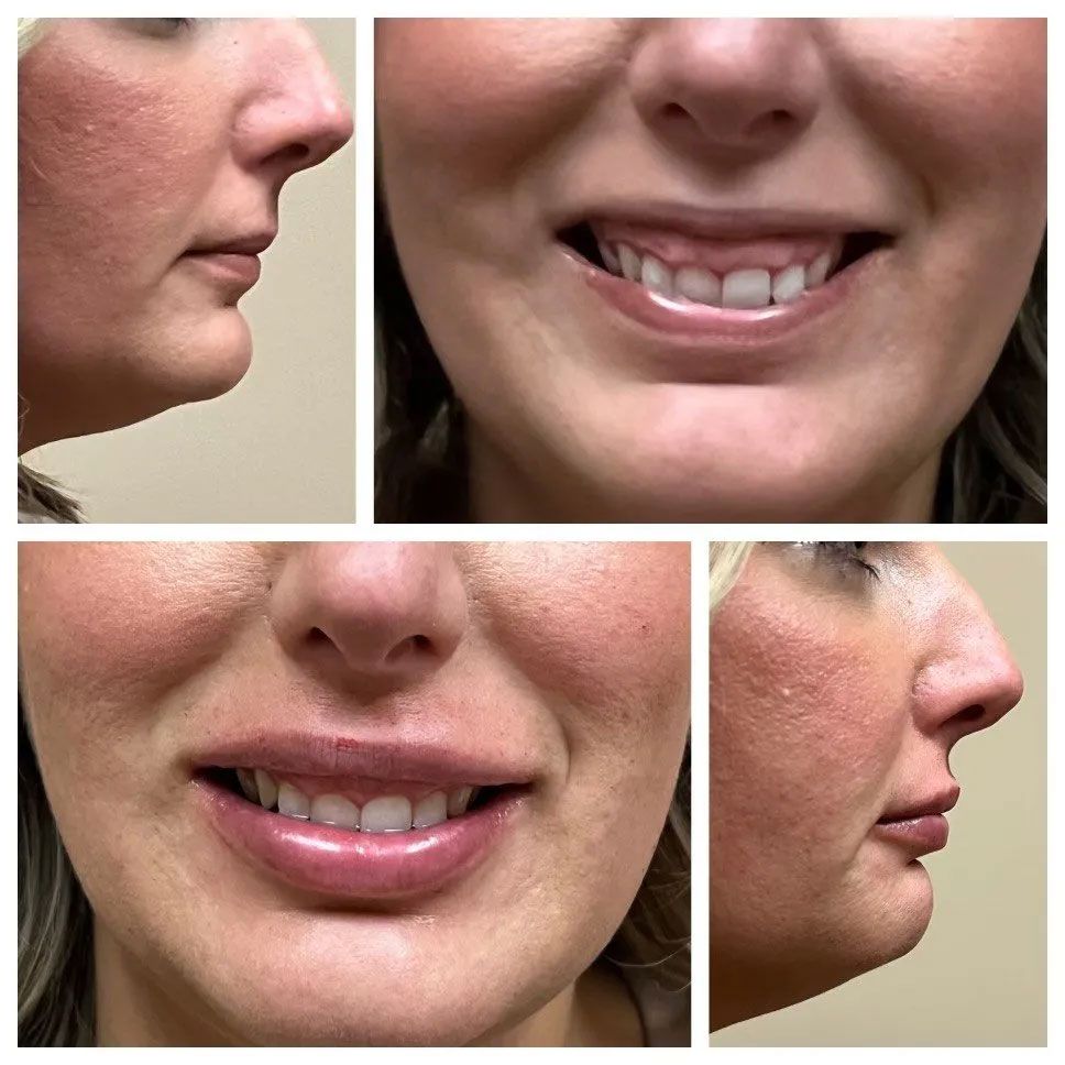 A woman 's face is shown in a collage of photos.