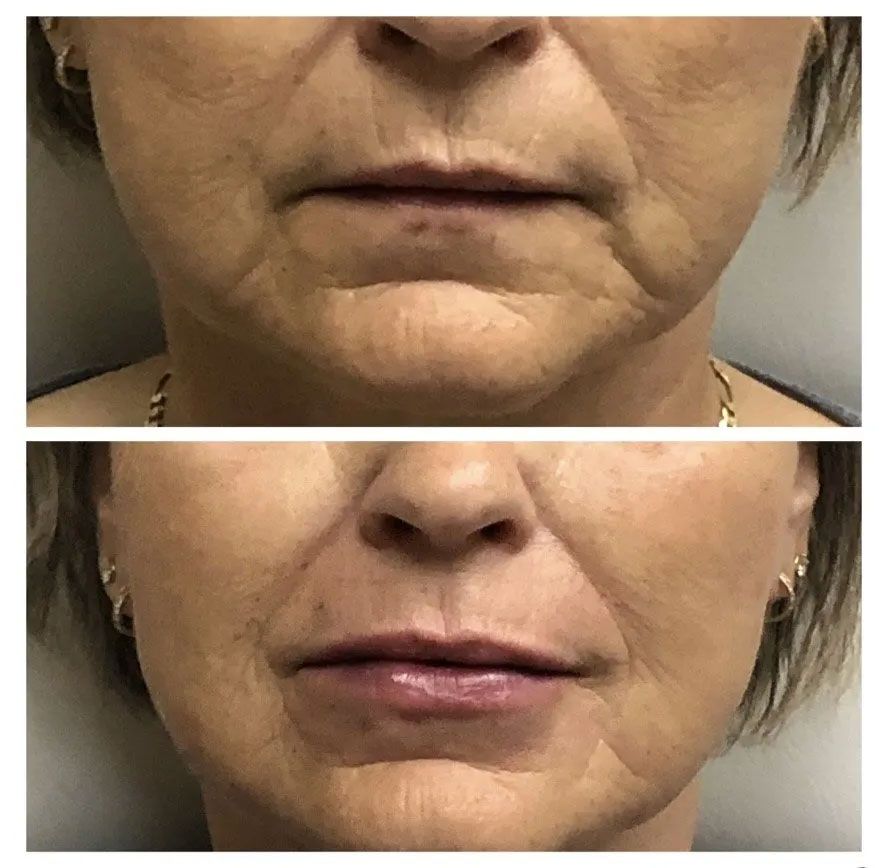 A before and after photo of a woman 's face.