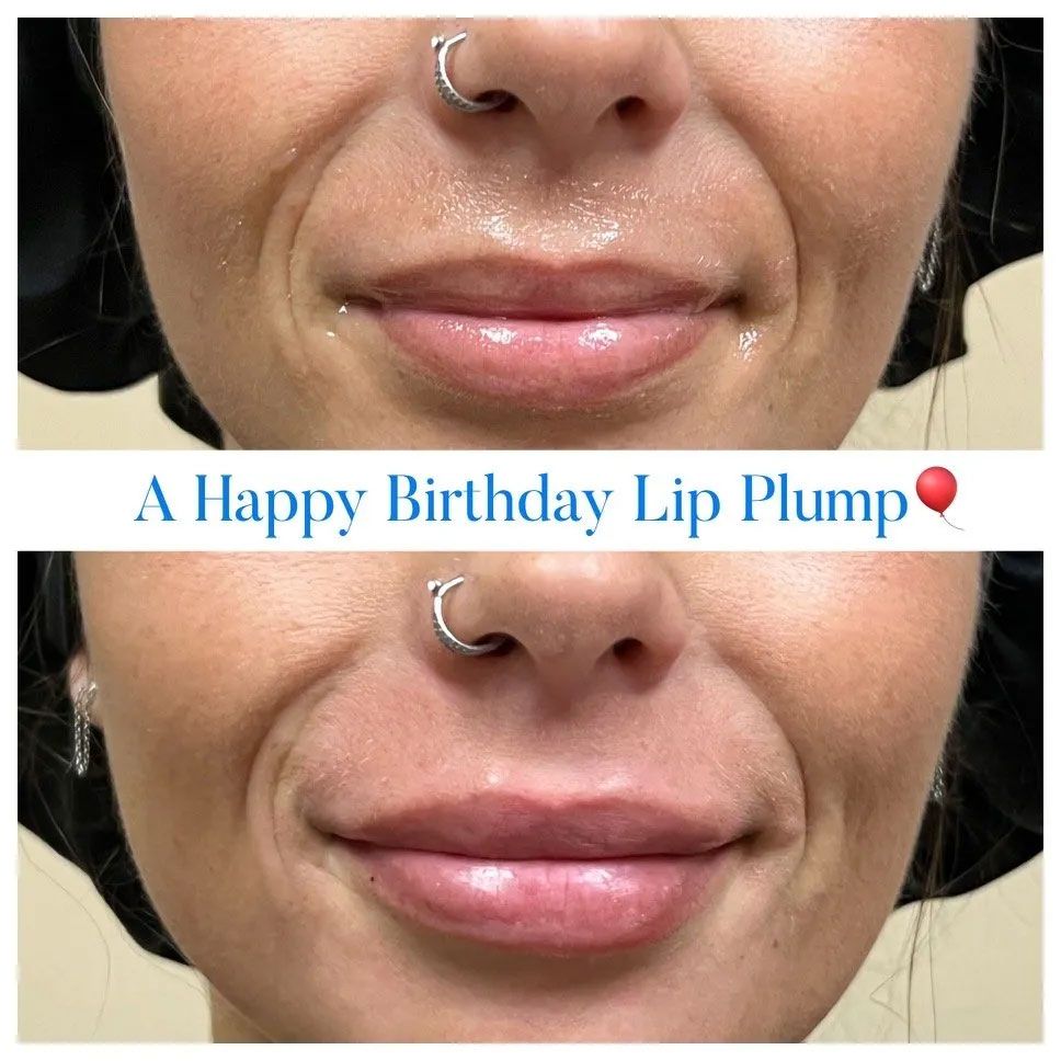 A before and after picture of a happy birthday lip plump