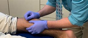 Doctor performing dry needling