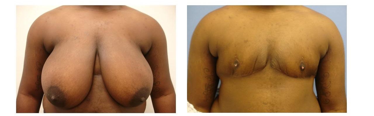 Female/Male Transition