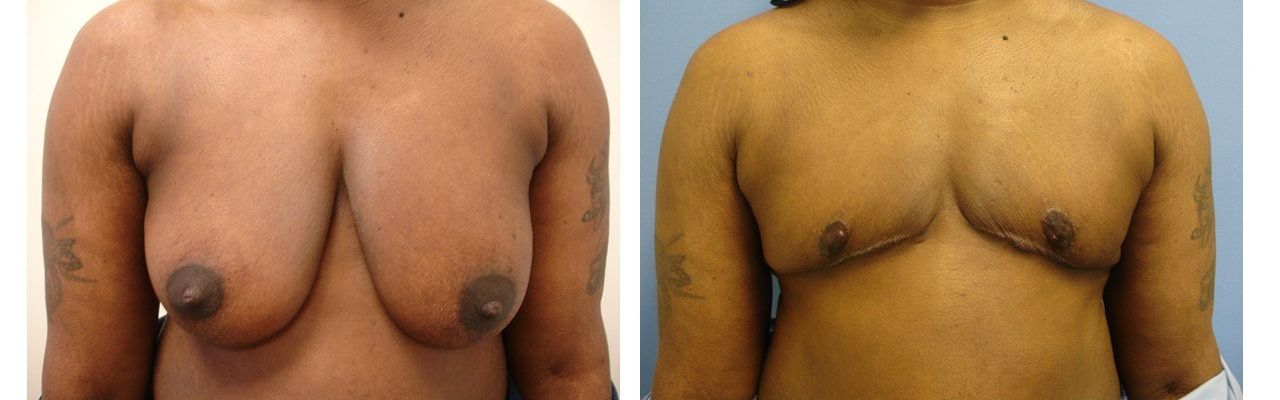 Female/Male Transition