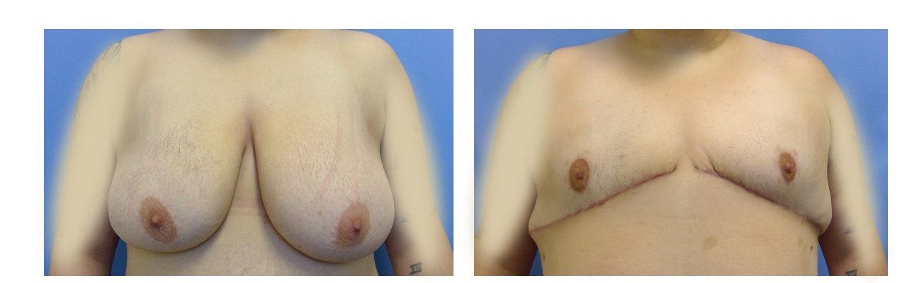 Female/Male Transition