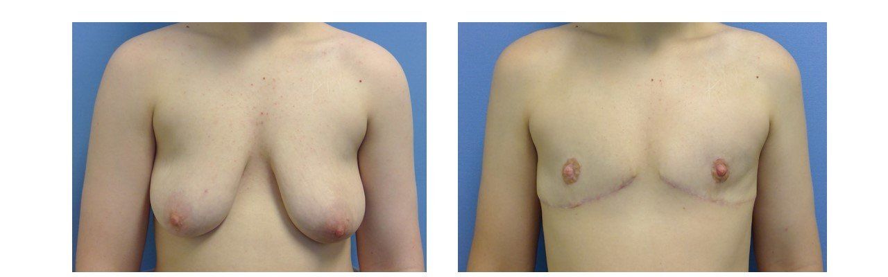 Female/Male Transition