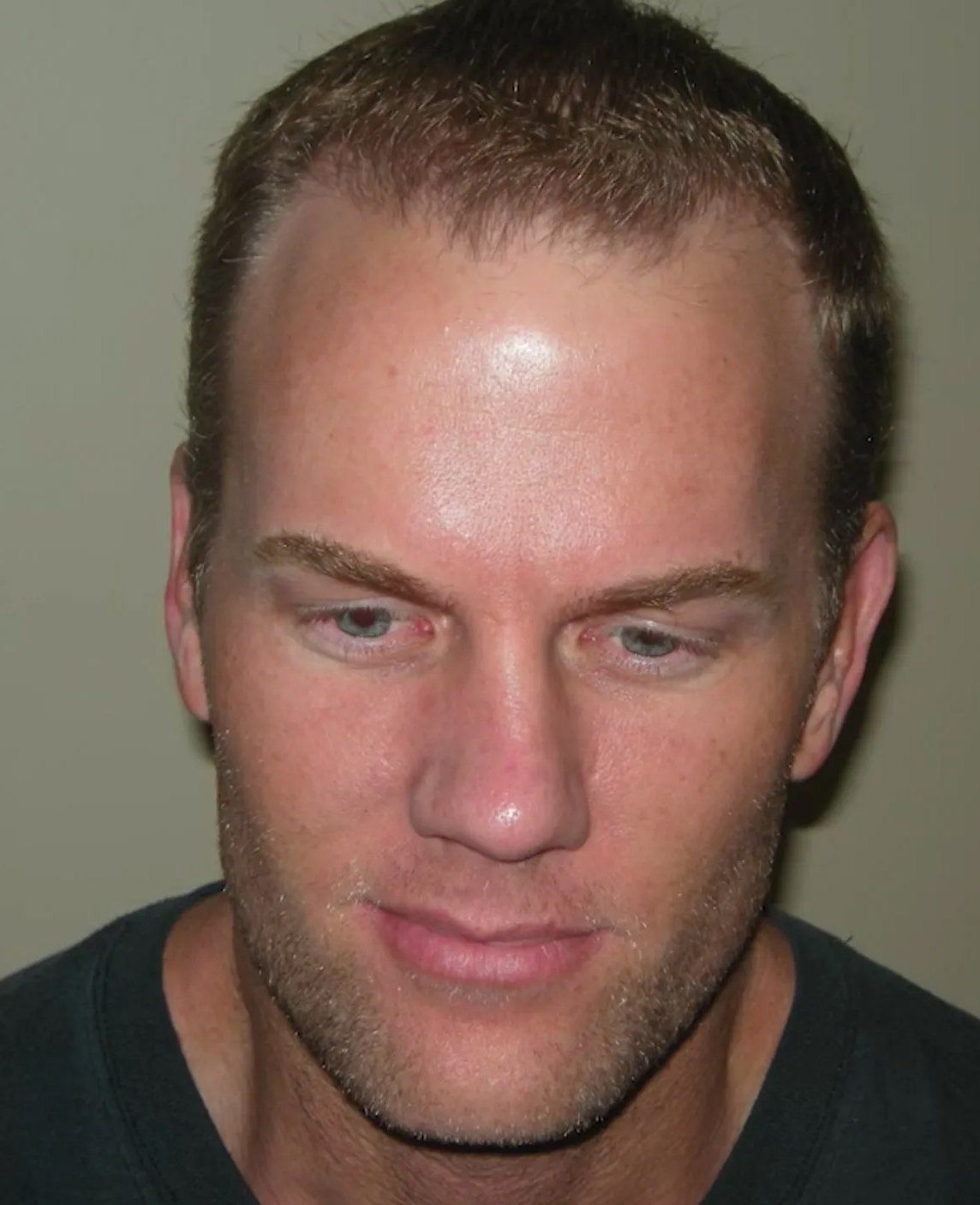 Hair restoration service