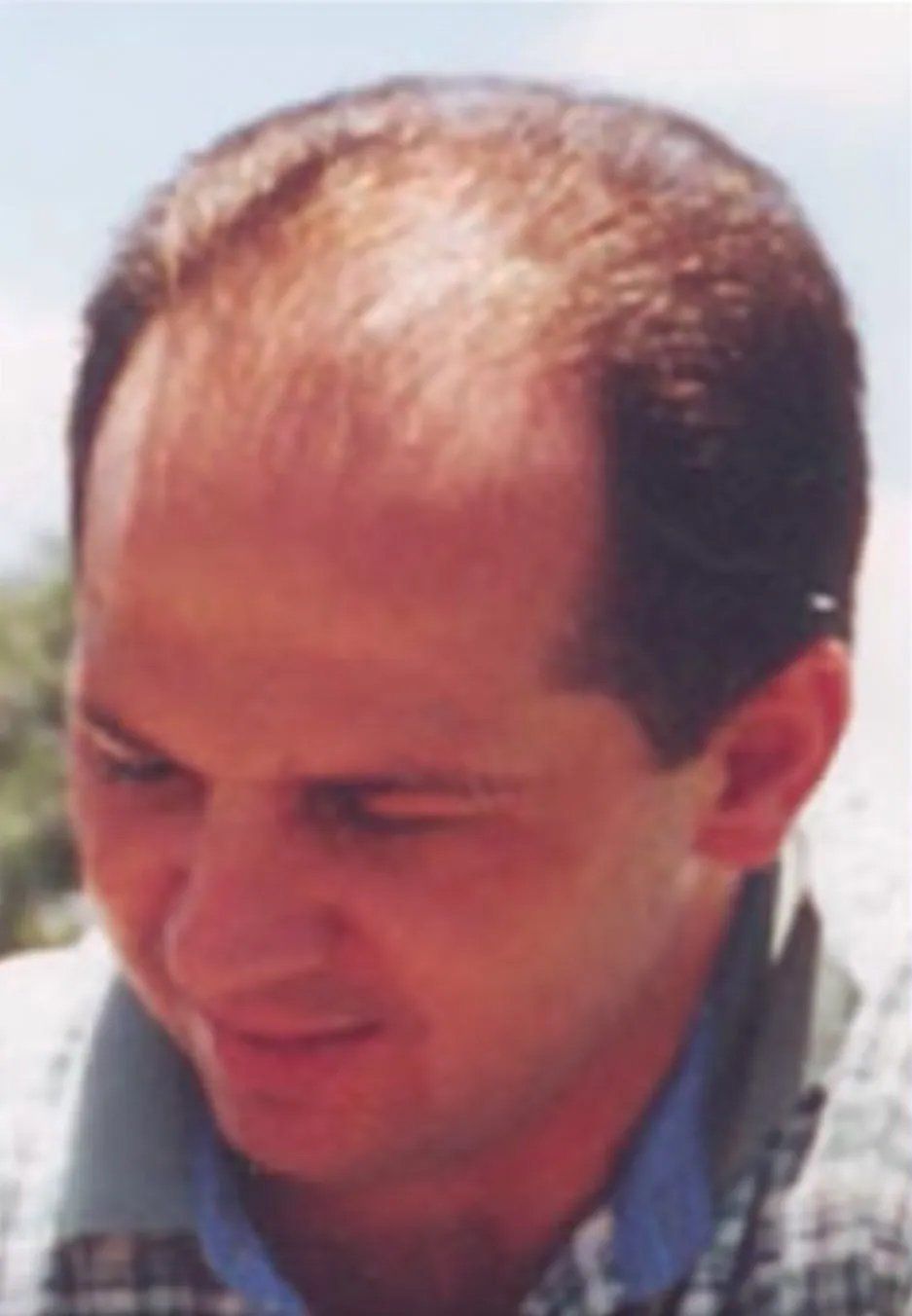 Hair restoration service