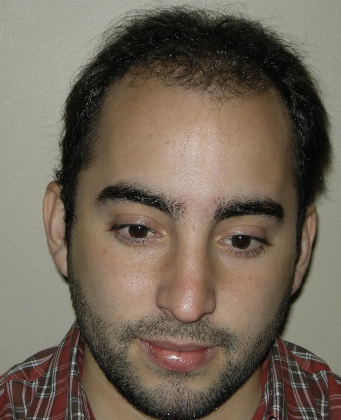 Hair restoration service