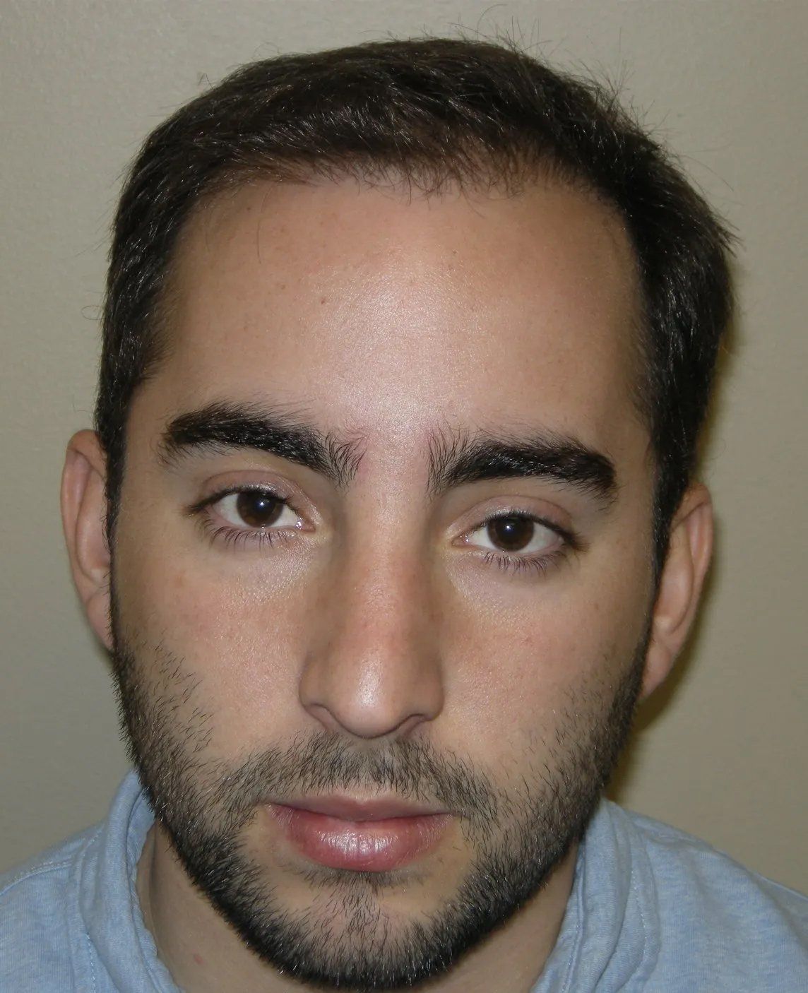 Hair restoration service