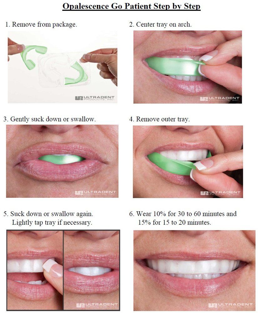 Opalescence Go