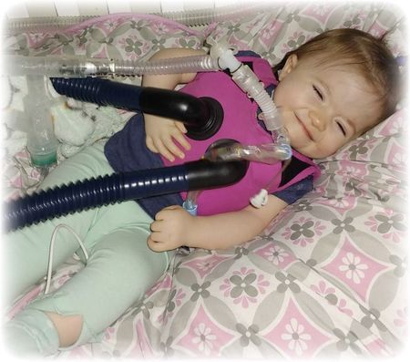 Smiling toddler wearing a medical vest and breathing tubes, lying in a bed with patterned bedding.