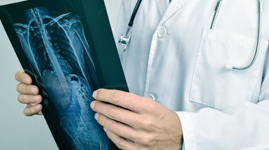 Doctor holding an x-ray result