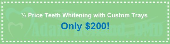 Tooth whitening | Rockaway, NJ | Adam Helfand, DMD | 973-361-9000