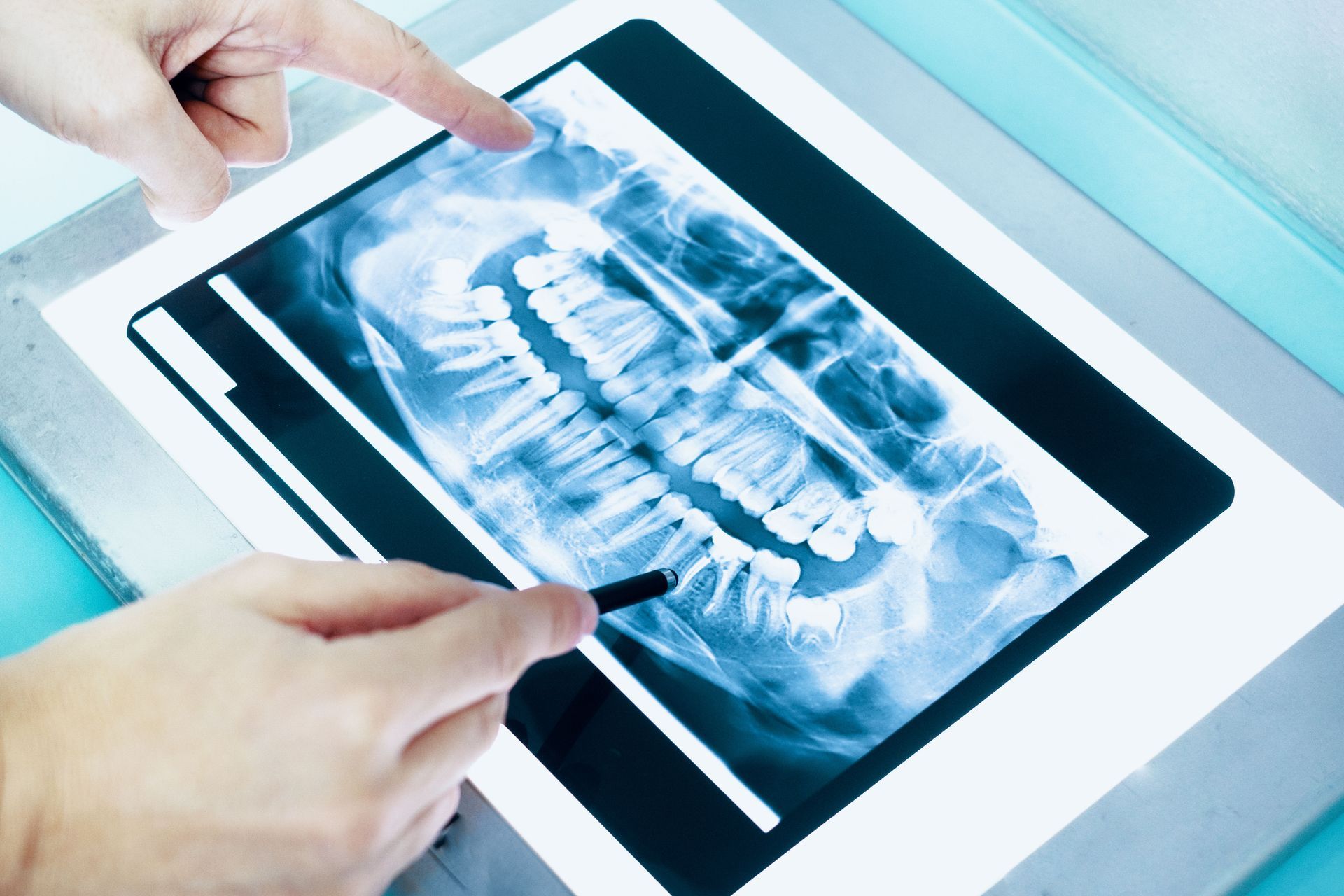 Transform Your Smile: Minimally Invasive Cosmetic Dentistry in Omaha, NE