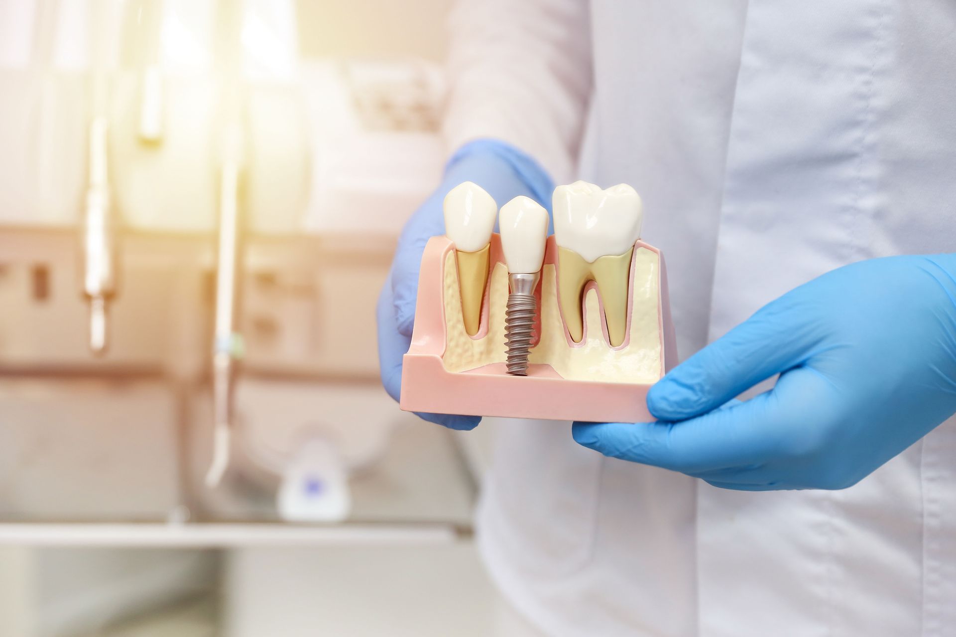 dental implants