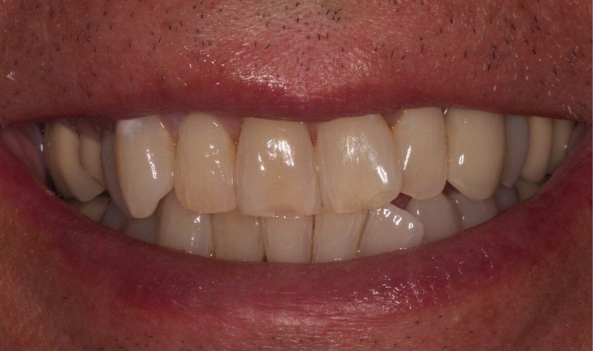after dental image