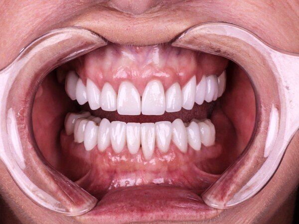 dental exams