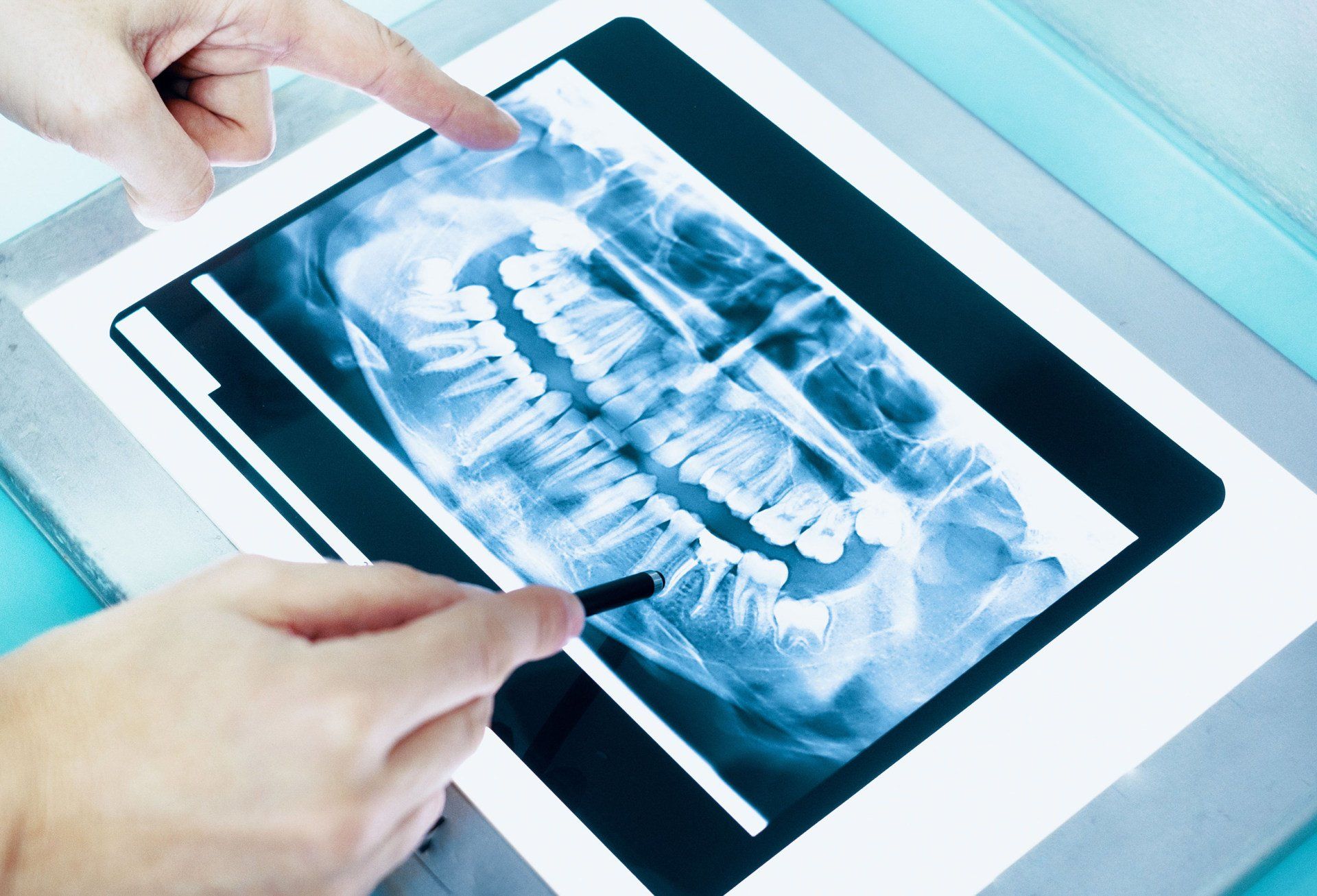 Teeth x-ray