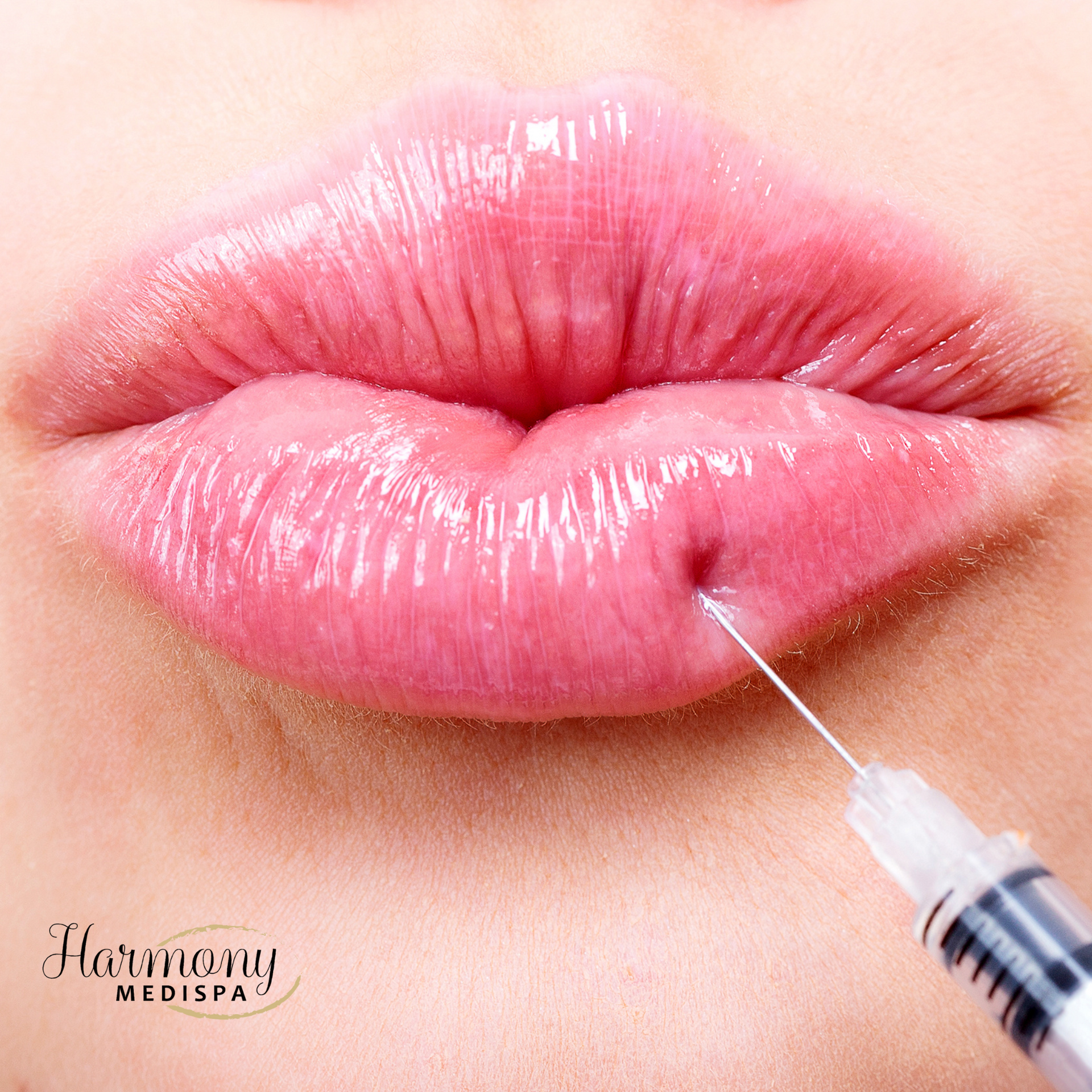 Lips receiving filler injection. Pink, glossy, close-up, medical spa setting. Syringe visible.