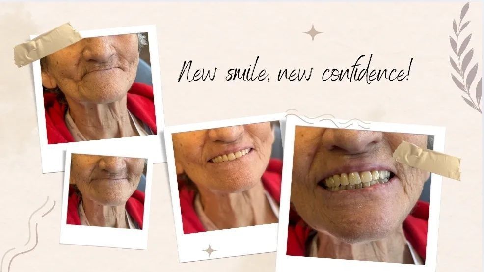 Collage of smiling teeth before and after dental work with text “New smile, new confidence!”
