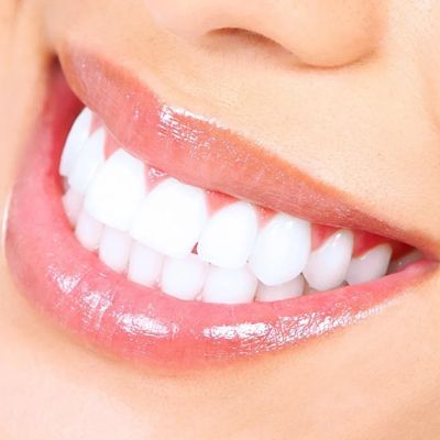 white teeth